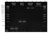 No Sample Loss After Treatment With Pureit Exozap PCR Cleanup