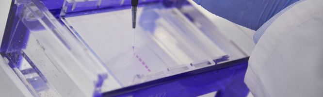 DIRECT GEL LOADING RED